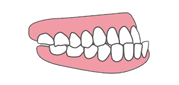 下顎全突（反対咬合、受け口）